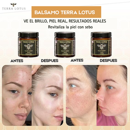 Terra Lotus Honey Balm 60ml – Bálsamo Regenerador Natural para la Piel